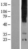 ls050833 tas2r16 human over expression lysates nm 016945 wb testing 1