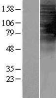 TAS2R1 Human Over-expression Lysates NM_019599