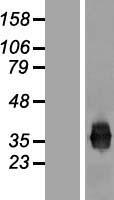 Junctional Adhesion Molecule 1 (F11R) Human Over-expression Lysates NM_016946