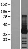 Junctional Adhesion Molecule 1 (F11R) Human Over-expression Lysates NM_144504