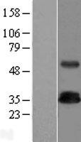 ls050852 trim trat1 human over expression lysates nm 016388 wb testing 1