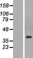 PAR6 (PARD6A) Human Over-expression Lysates NM_001037281