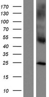 CLECSF6 (CLEC4A) Human Over-expression Lysates NM_016184