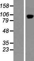 PDE11A Human Over-expression Lysates NM_016953