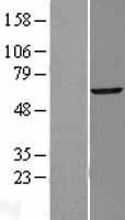 TBX22 Human Over-expression Lysates NM_016954
