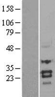 Sclerostin (SOST) Human Over-expression Lysates NM_025237