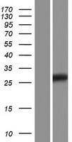 TMED5 Human Over-expression Lysates NM_001167830