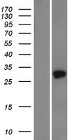 TMED5 Human Over-expression Lysates NM_016040