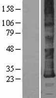 DERL2 Human Over-expression Lysates NM_016041