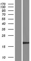EXOSC3 Human Over-expression Lysates NM_001002269
