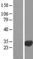 EXOSC3 Human Over-expression Lysates NM_016042