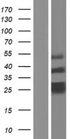 TMED7 Human Over-expression Lysates NM_181836