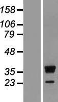 RRP15 Human Over-expression Lysates NM_016052