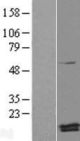 PAM16 Human Over-expression Lysates NM_016069