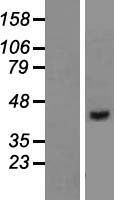 VPS36 Human Over-expression Lysates NM_016075