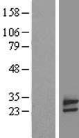 ls051030 fam18b tvp23b human over expression lysates nm 016078 wb testing 1