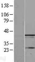 ls051035 ubxn1 human over expression lysates nm 015853 wb testing 1