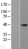 SIA8C (ST8SIA3) Human Over-expression Lysates NM_015879