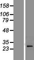 Protease Inhibitor 15 (PI15) Human Over-expression Lysates NM_015886