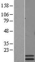ls051052 prlh human over expression lysates nm 015893 wb testing 1
