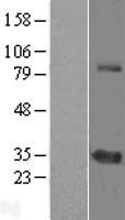 ZNF691 Human Over-expression Lysates NM_015911