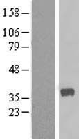 CALHM2 Human Over-expression Lysates NM_015916