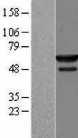 NMD3 Human Over-expression Lysates NM_015938