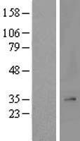 MRPL2 Human Over-expression Lysates NM_015950