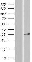 DERA Human Over-expression Lysates NM_015954