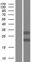 TMX2 Human Over-expression Lysates NM_001144012