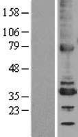 TMX2 Human Over-expression Lysates NM_015959