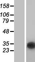 CUTC Human Over-expression Lysates NM_015960