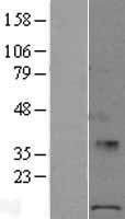 POLR1D Human Over-expression Lysates NM_015972
