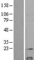 Galanin (GAL) Human Over-expression Lysates NM_015973