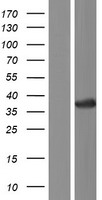CRYL1 Human Over-expression Lysates NM_015974