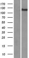 CHREBP (MLXIPL) Human Over-expression Lysates NM_032951