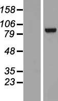 TNNI3K Human Over-expression Lysates NM_015978