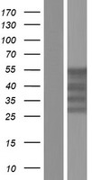 YBX2 Human Over-expression Lysates NM_015982