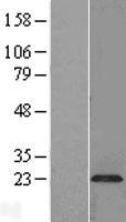 ls051090 plasmolipin pllp human over expression lysates nm 015993 wb testing 1