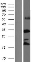 RRNAD1 Human Over-expression Lysates NM_001142560