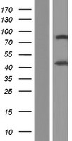 ls051094 adiponectin receptor 1 adipor1 human over expression lysates nm 015999 wb testing 2