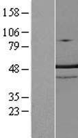 TRNT1 Human Over-expression Lysates NM_016000