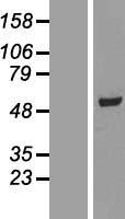 SCCPDH Human Over-expression Lysates NM_016002
