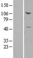 IFT52 Human Over-expression Lysates NM_016004