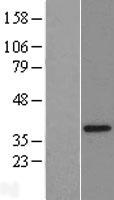 CGI 62 (ZC2HC1A) Human Over-expression Lysates NM_016010
