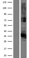 FAM108B1 (ABHD17B) Human Over-expression Lysates NM_016014