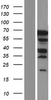 PHF20L1 Human Over-expression Lysates NM_032205