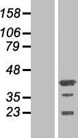 PHF20L1 Human Over-expression Lysates NM_198513