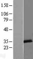 LACTB2 Human Over-expression Lysates NM_016027