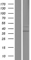 SUV420h1 (KMT5B) Human Over-expression Lysates NM_016028